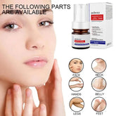 Niacinamid Serum Entfernen Dunkle Flecken Melasma Chloasma Schwarz Sommersprossen Gesicht Hautpflege Creme Aufhellung Feuchtigkeit Leistungsstarke Entfernung